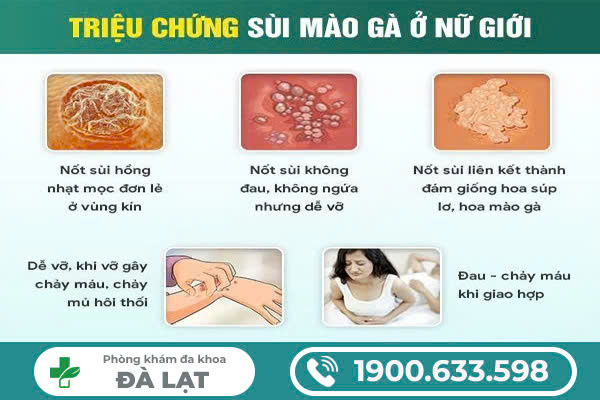 Hình ảnh minh họa